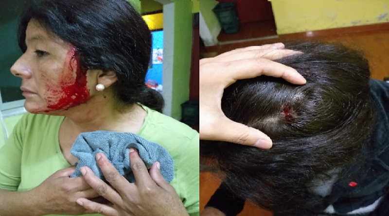 Callao: trabajadora de limpieza fue atacada de manera salvaje [FOTOS]